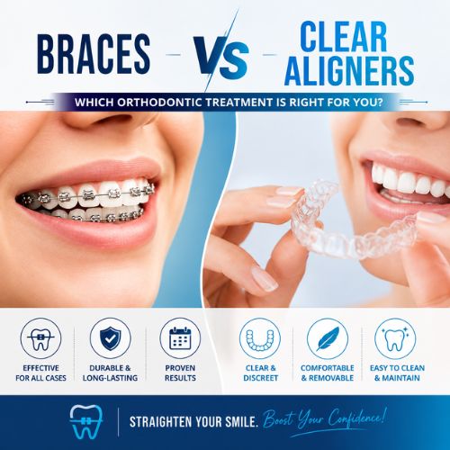 Braces vs Clear Aligners: Which Orthodontic Treatment Is Right for You?