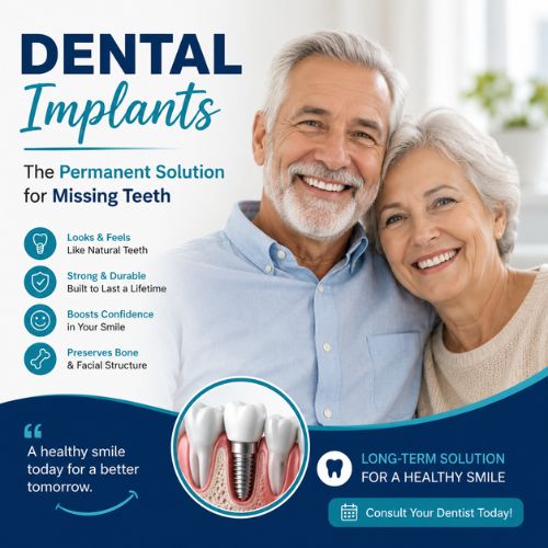 Dental Implants: The Permanent Solution for Missing Teeth